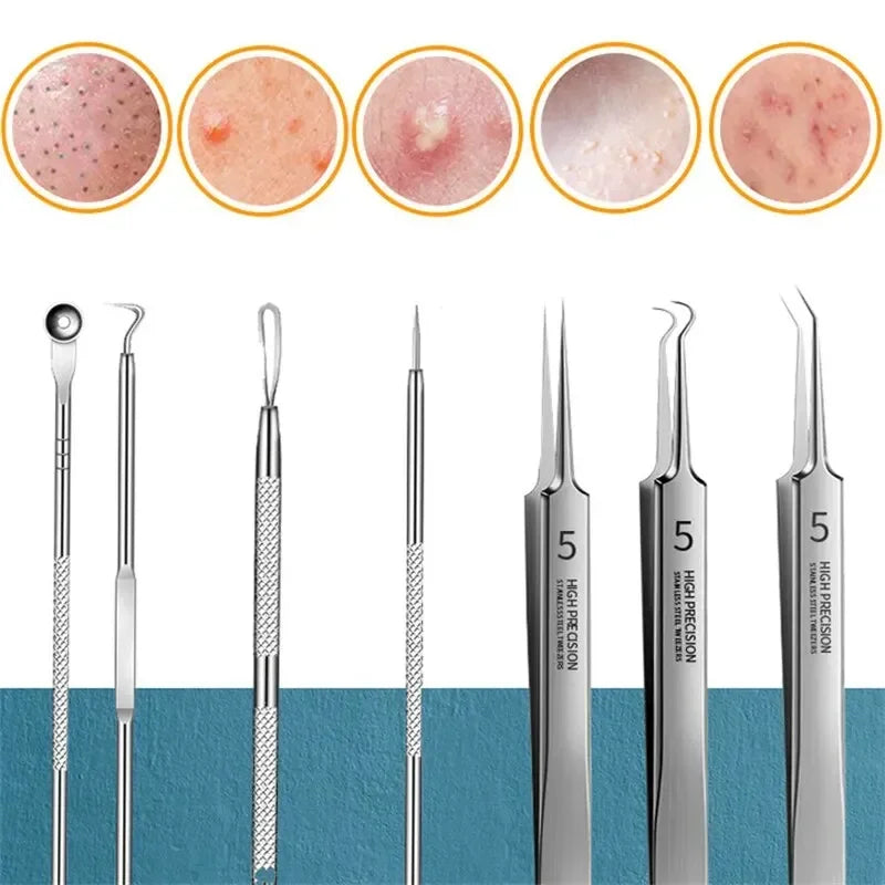11-Piece Blackhead & Blemish Removal Tool Set - Acne Extractor Kit for Clear, Smooth Skin